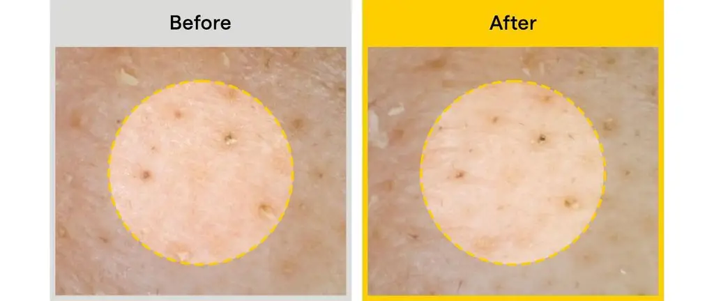 [포켓몬에디션/블랙헤드1등] 마녀공장 퓨어 소이빈 클렌징오일 200ml 2입 기획 (+미니백 키링) 상세페이지 23